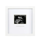 Sonogram Picture Frame